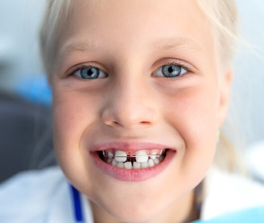 Girl with Phase-One Orthodontics in Dallas