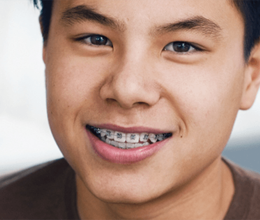close up of boy with braces smiling