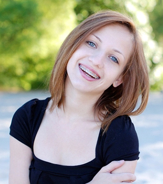 A young girl smiling while wearing traditional metal braces in Dallas to straighten her smile