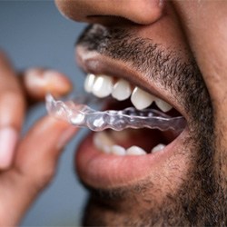 a man wearing Invisalign aligners in Dallas