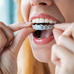 Woman about to wear aligner for Invisalign in Dallas, TX