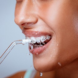 Dallas patient using water flosser on braces