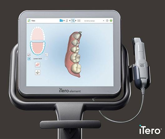 iTero Digital Scanner